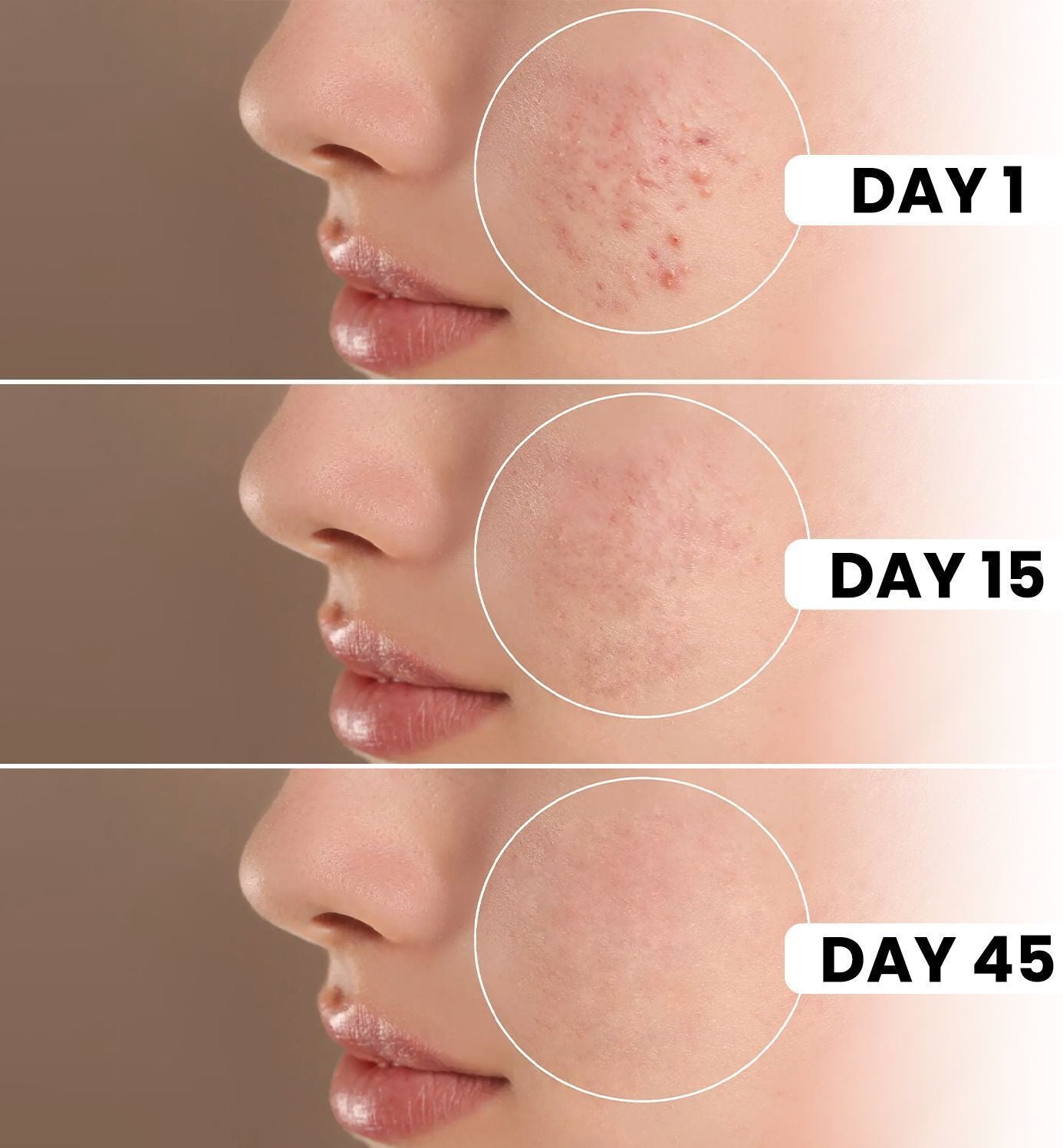 6IN1 Expert Facewash -  (100ml)