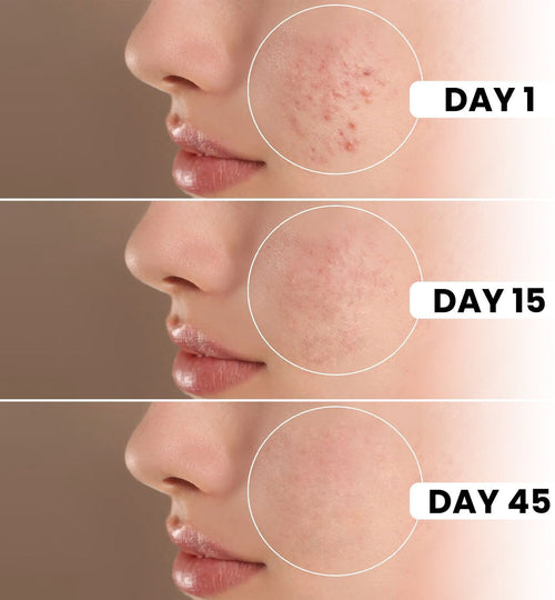 6IN1 Expert Facewash -  (100ml)