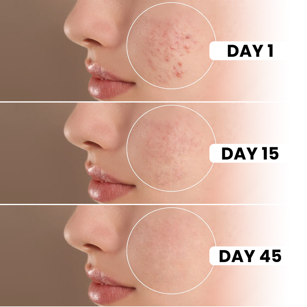 Merciaura Clear Skin Duo  6-in-1 Expert Face Wash (100 ml) + UV Armor Sunscreen SPF 50 PA++++ (100 ml)