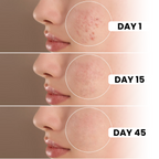 Merciaura Clear Skin Duo  6-in-1 Expert Face Wash (100 ml) + UV Armor Sunscreen SPF 50 PA++++ (100 ml)