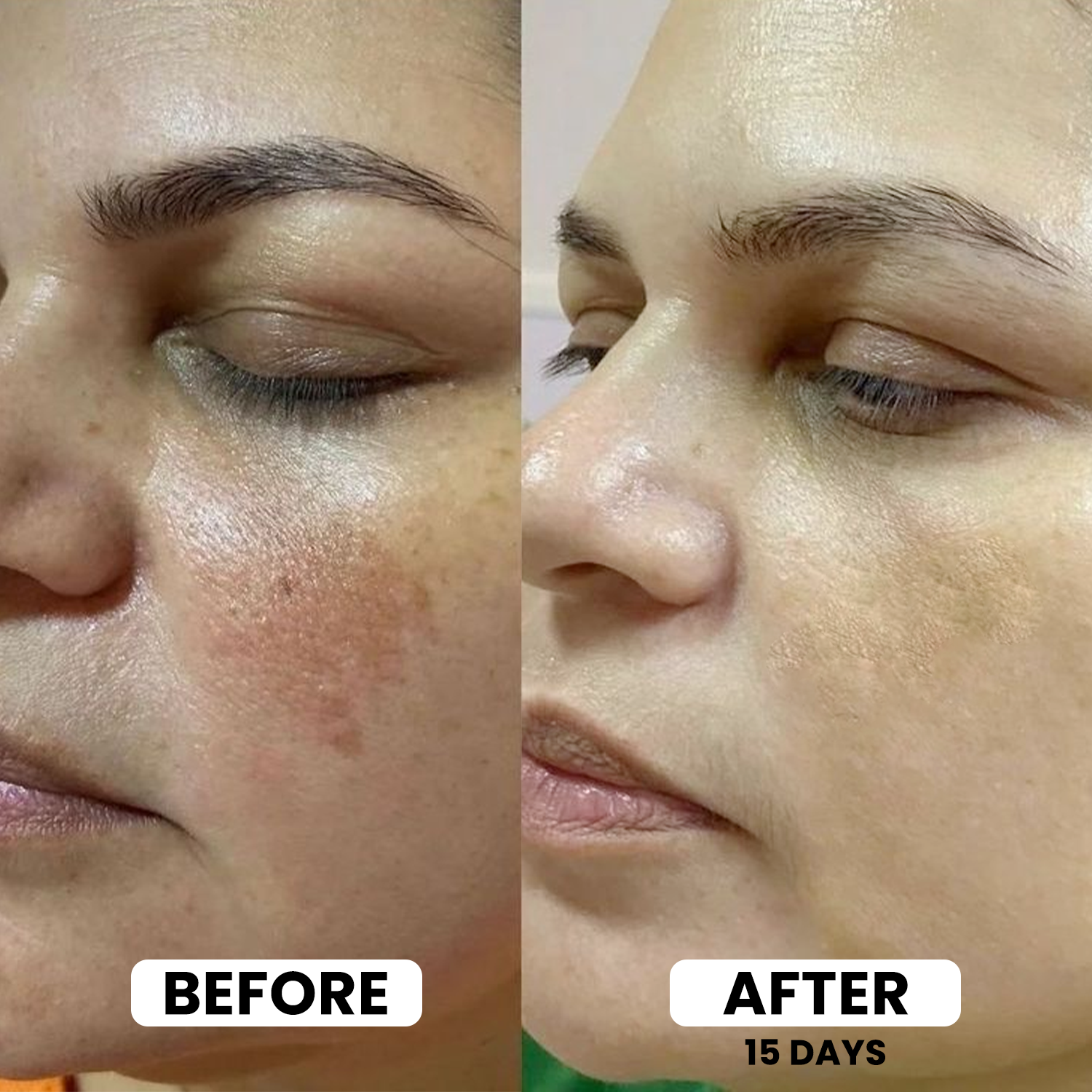 6IN1 Expert Facewash -  (100ml)