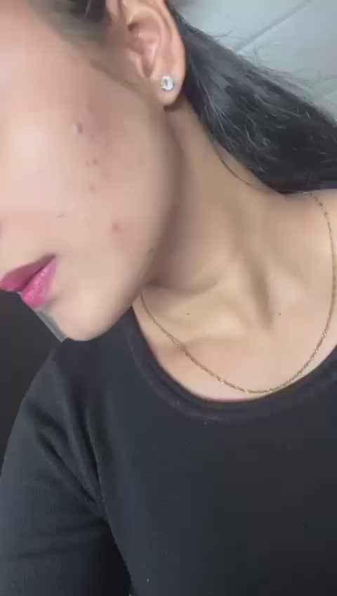 Merciaura Clear Skin Duo  6-in-1 Expert Face Wash (100 ml) + UV Armor Sunscreen SPF 50 PA++++ (100 ml)