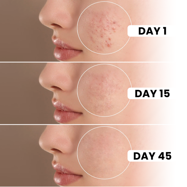 6IN1 Expert Facewash